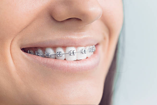 Best Dental Exams and Cleanings  in Bradford, OH